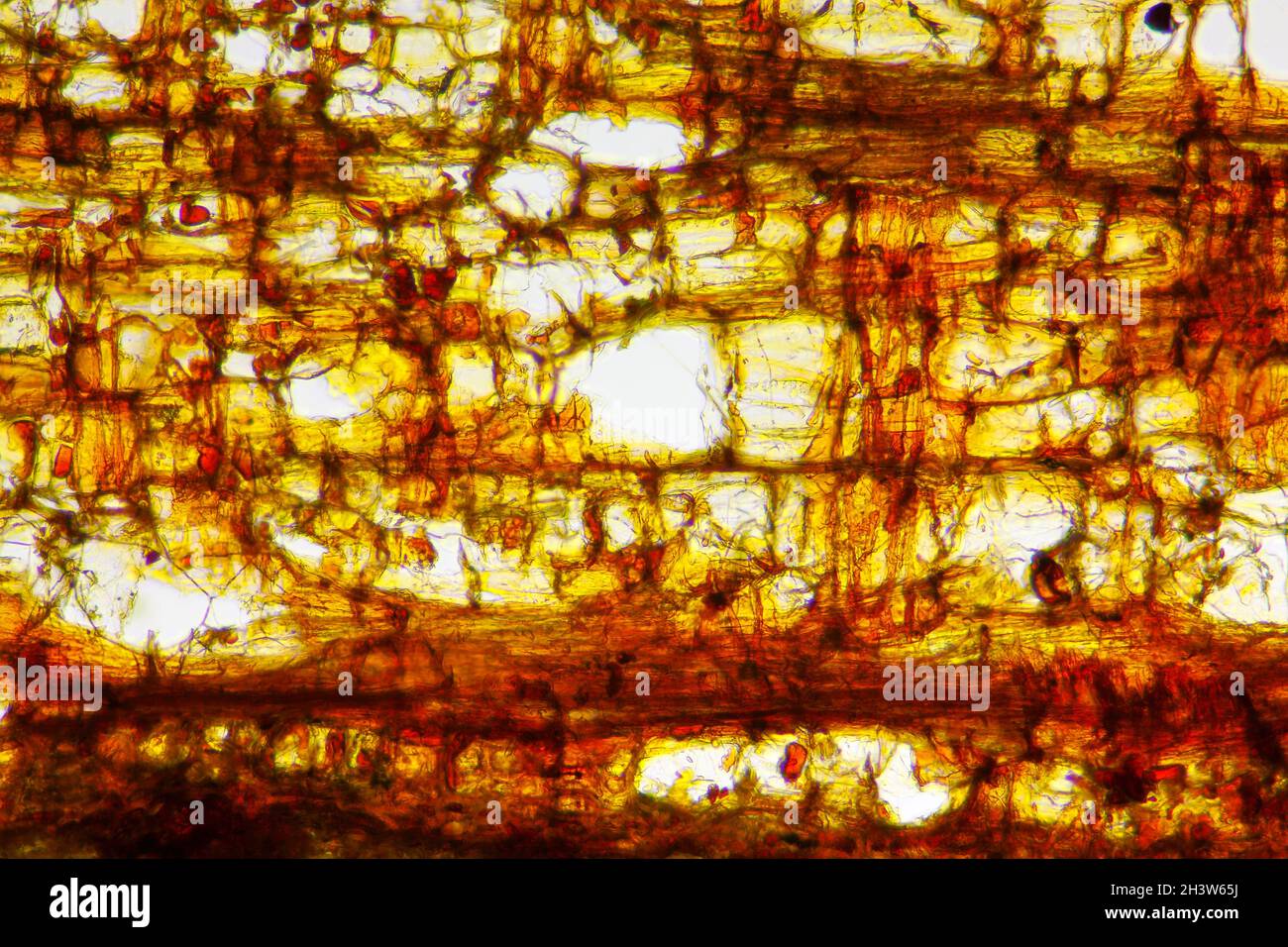 Vista microscopica della sezione di corteccia di pino scozzese (Pinus sylvestris). Illuminazione a campo chiaro. Foto Stock