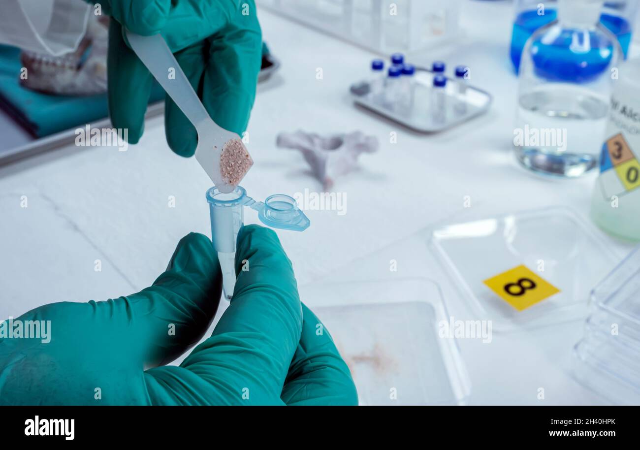 Lo scienziato forense deposita un campione di osso vertebrale dallo scheletro umano per l'indagine sull'omicidio nel laboratorio di criminalità, immagine concettuale Foto Stock