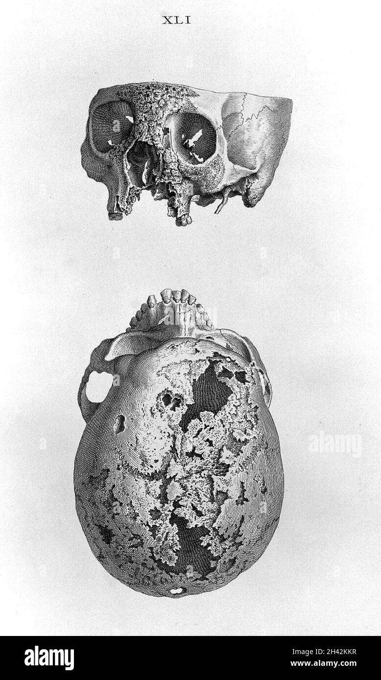 Cheselden, Osteografia, impressione senza lettere. Foto Stock