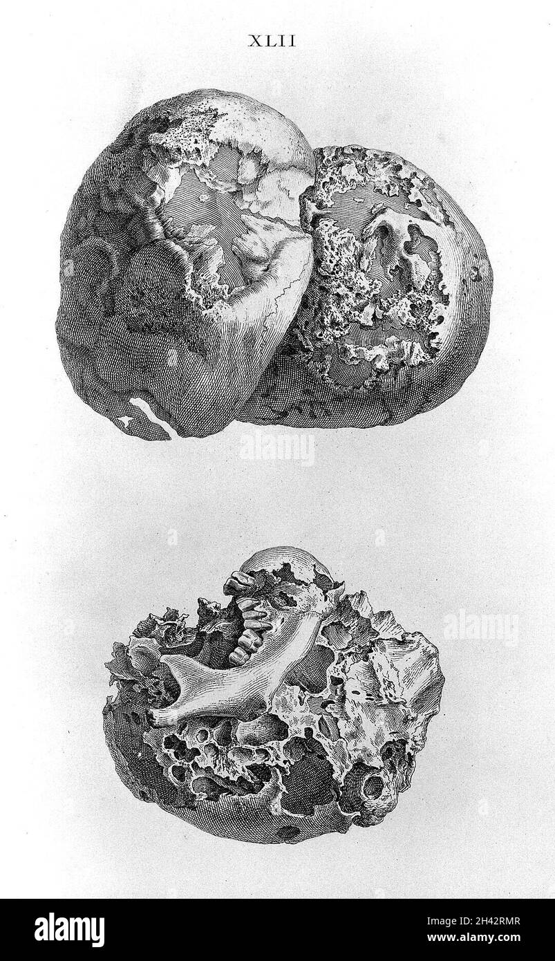 Cheselden, Osteografia, impressione senza lettere. Foto Stock