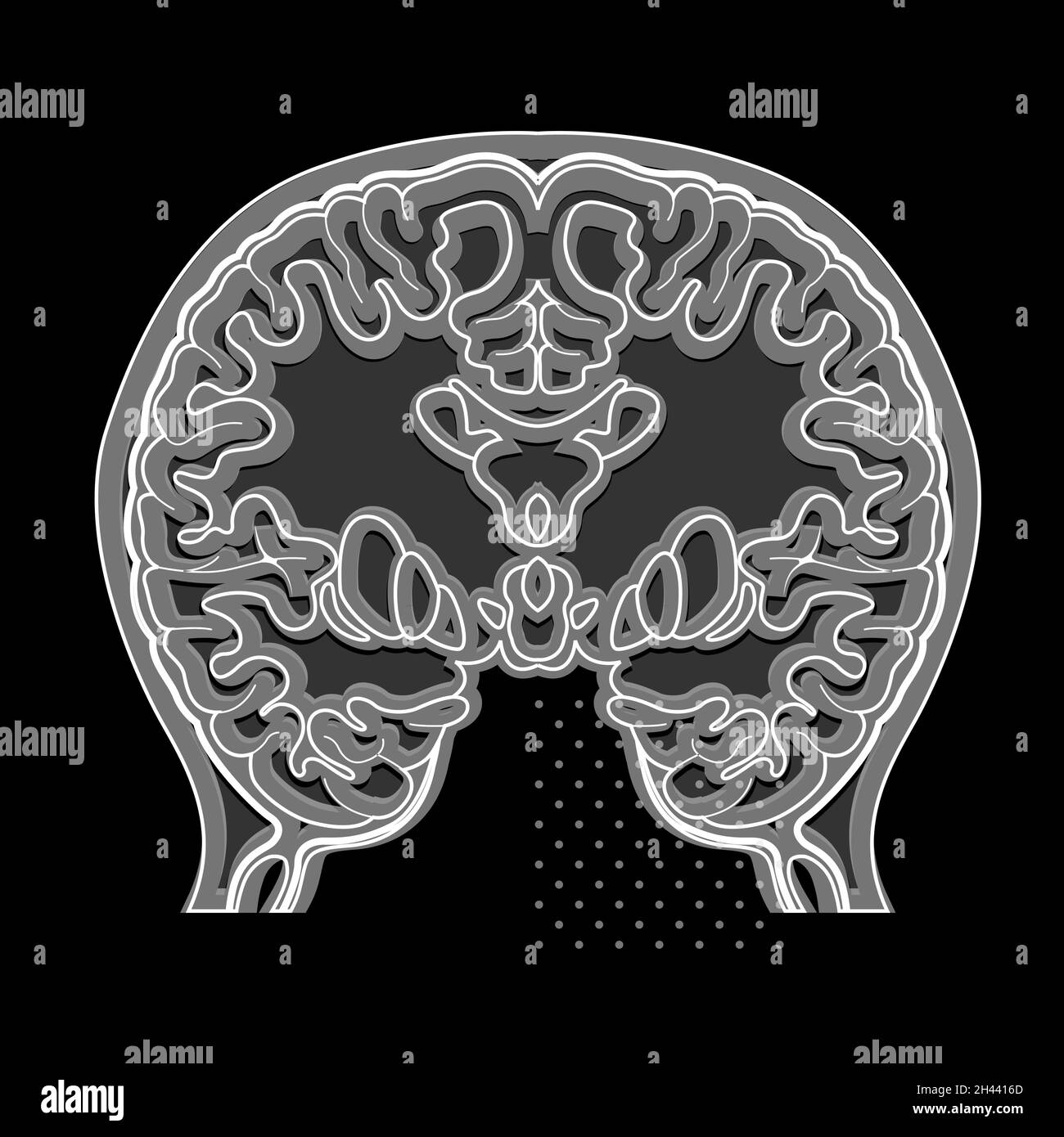Brain Transverse Section Scan (scansione sezione trasversale cervello) - Illustrazione come file EPS 10 Illustrazione Vettoriale
