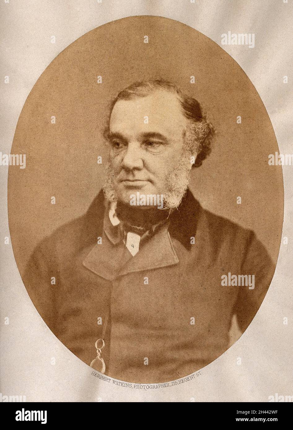 Thomas Addison. Fotografia di H. Watkins. Foto Stock