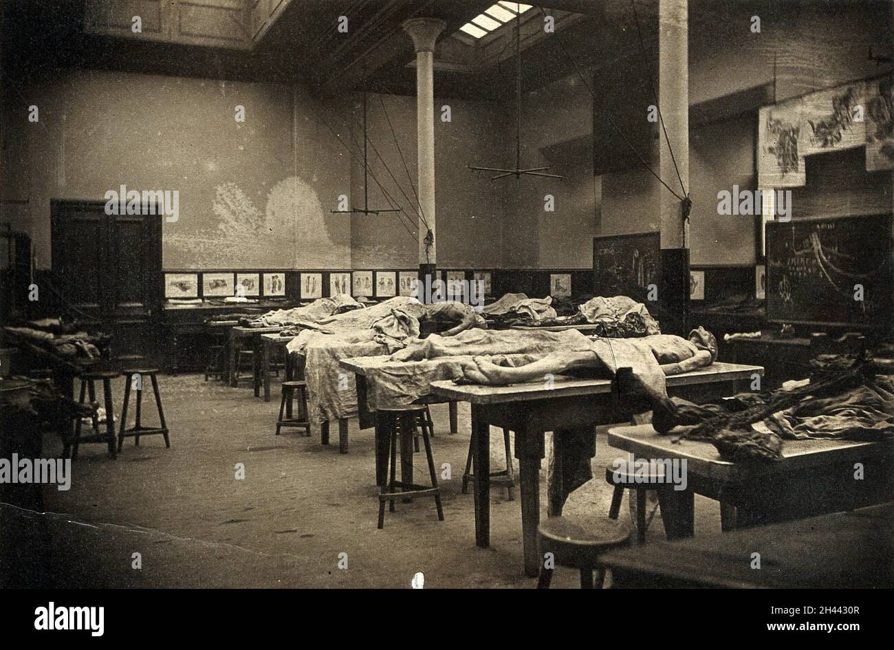 L'interno di una sala di dissezione a Edimburgo, con cadaveri semi-coperti su panchine. Fotografia, 1889. Foto Stock