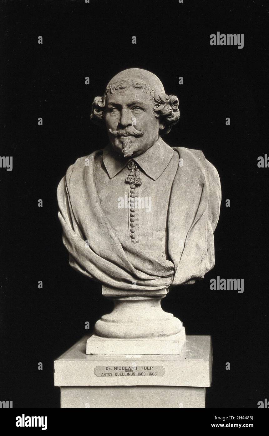 Nicolaas Tulp. Fotografia, 1927, dopo un busto di terracotta di Artus Quellinus. Foto Stock