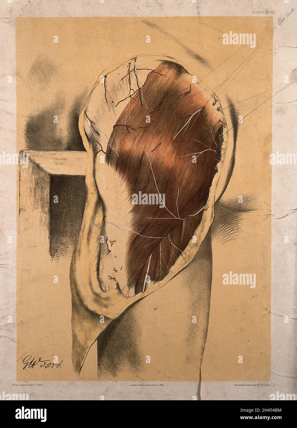 Dissezione della coscia superiore e natiche di un uomo, mostrando i muscoli e i vasi sanguigni. Litografia di G.H. Ford, 1866. Foto Stock