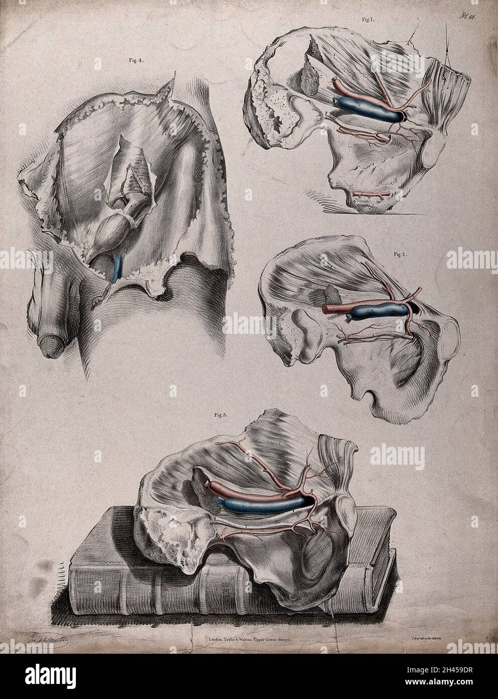 Il sistema circolatorio: Dissezioni del sistema riproduttivo maschile e dell'osso pelvico, con le arterie e le vene indicate in rosso e blu. Una dissezione è mostrata poggiando su un libro di C. Bell. Litografia colorata di J. Maclise, 1841/1844. Foto Stock