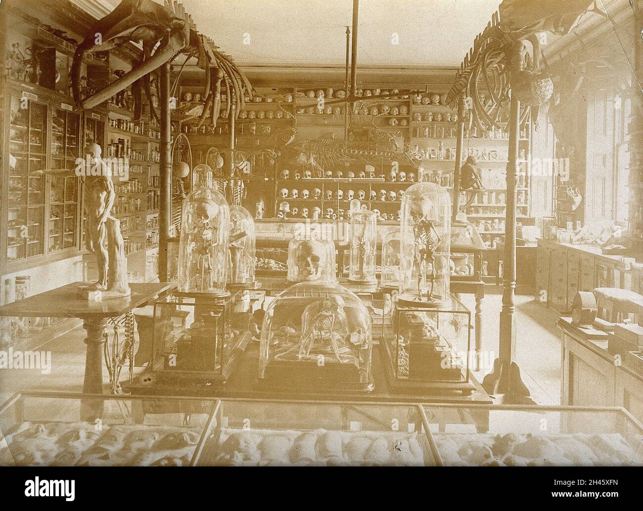 Il Royal United Hospital, Bath: Il museo, con scheletri umani e animali e teschi in mostra. Foto, ca. 1870. Foto Stock