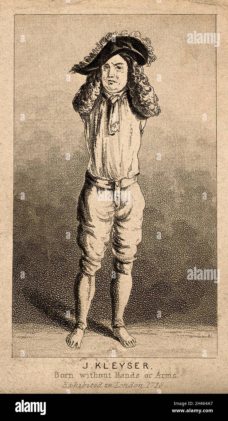 Johann Kleyser, un uomo nato senza armi. Aquatint. Foto Stock