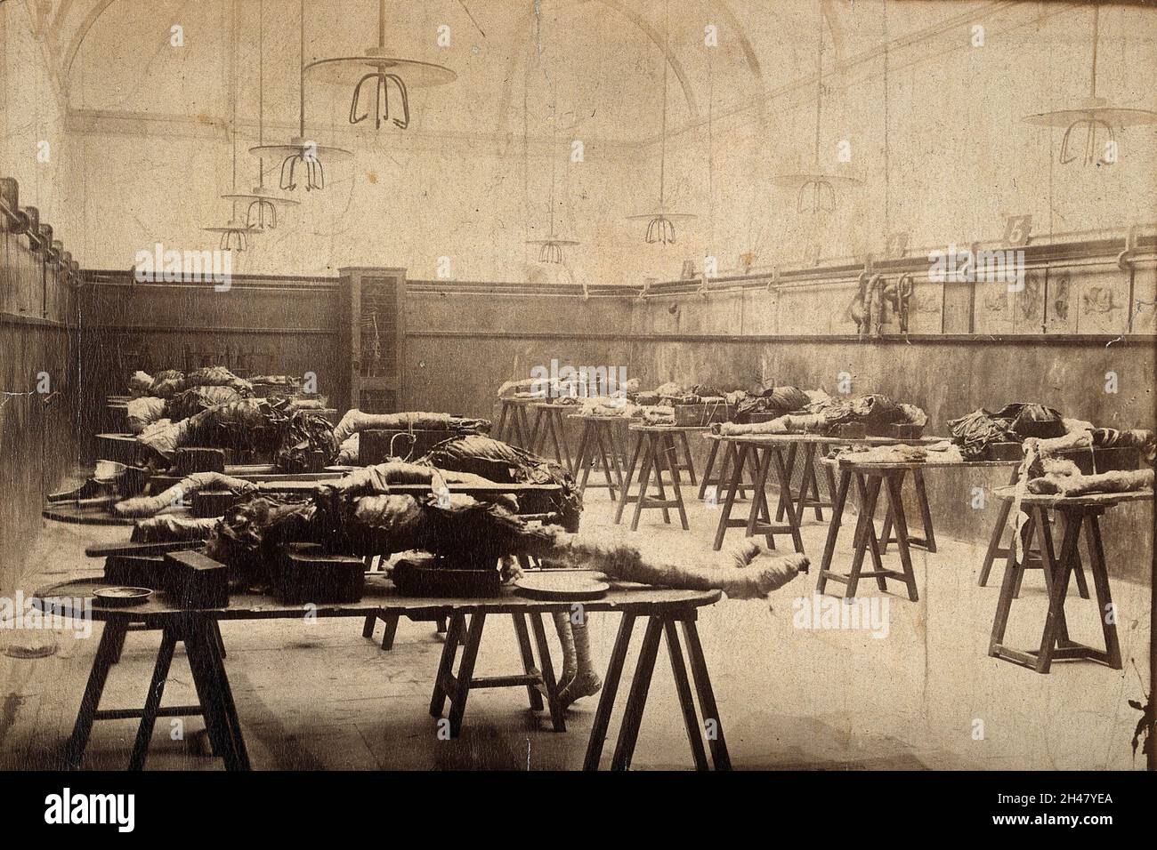 L'interno di una sala dissezione ospedale a Londra, con linee di cadaveri su panchine. Fotografia. Foto Stock