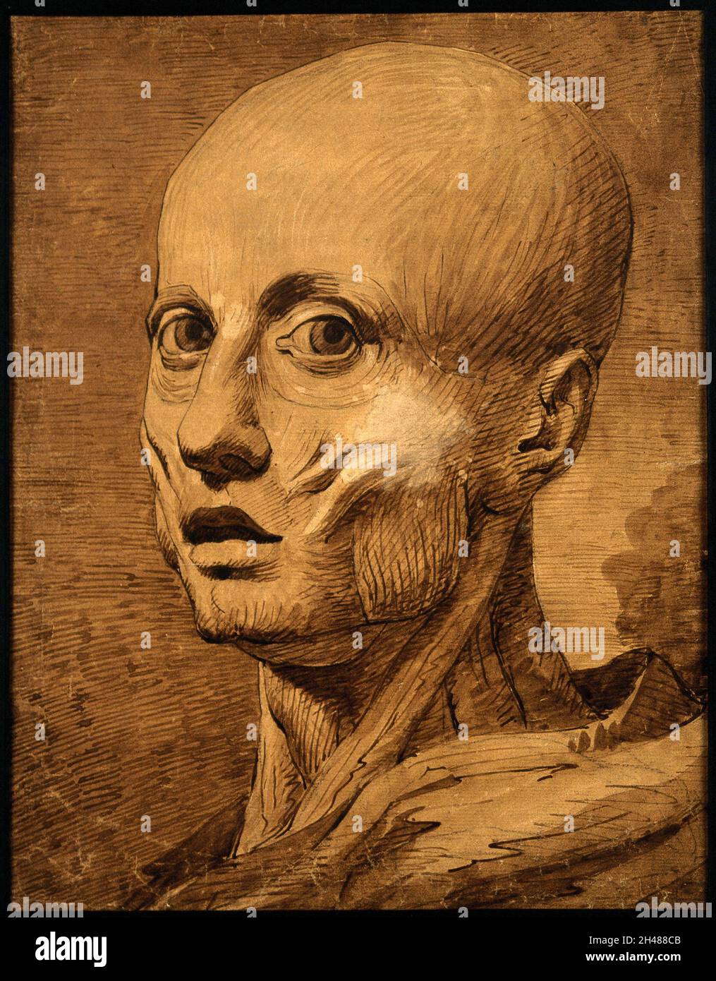 Studio anatomico della testa di Henry Jenkins, di 169 anni. Disegno penna e inchiostro. Foto Stock