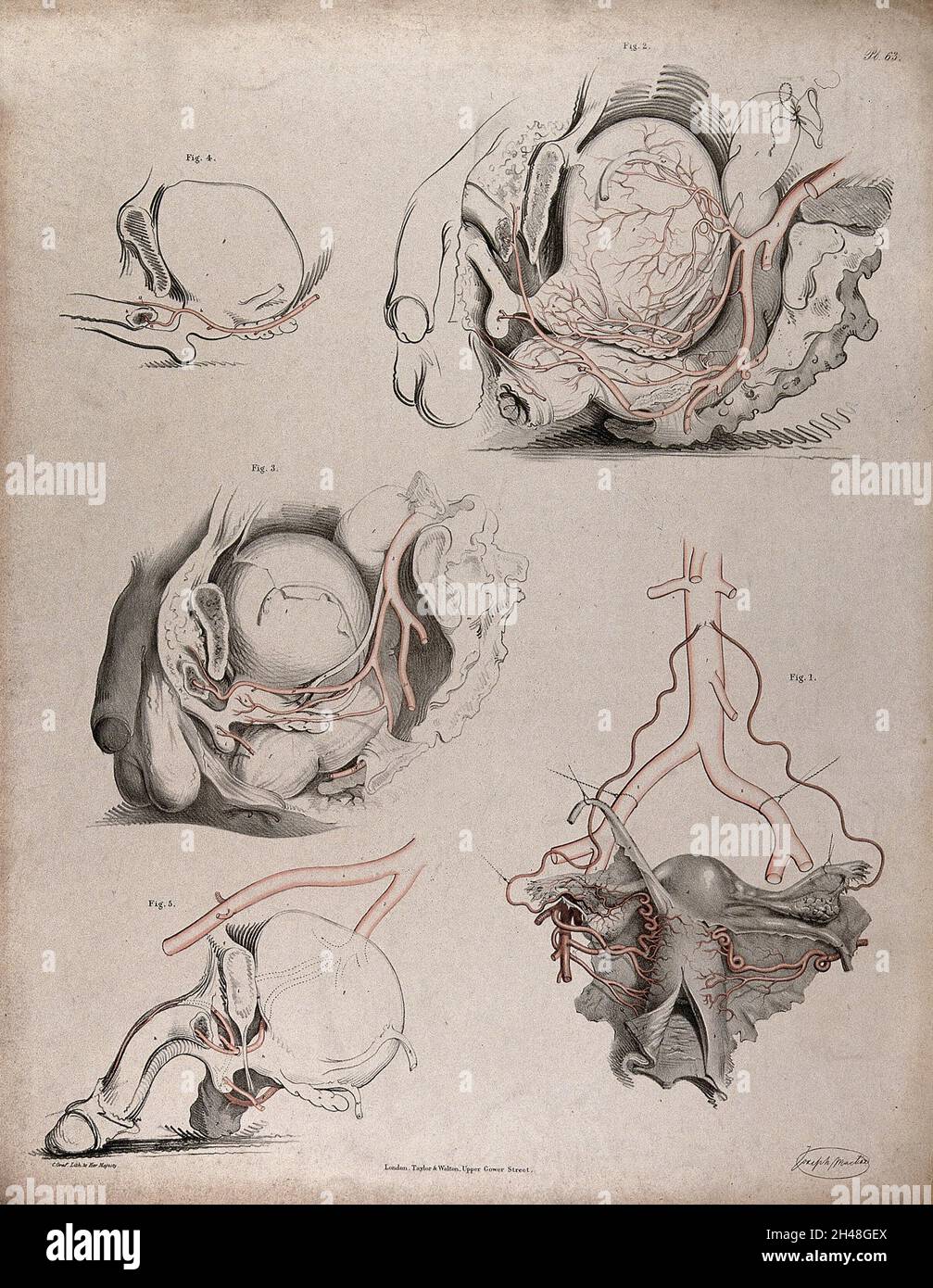 Il sistema circolatorio: Dissezioni del sistema riproduttivo maschile, con le arterie (?) indicato in rosso. Litografia colorata di J. Maclise, 1841/1844. Foto Stock