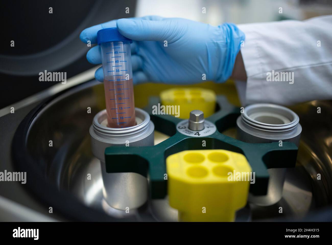 Un assistente di laboratorio medico preleva una provetta per centrifuga con liquido dalla centrifuga, Essen, Renania settentrionale-Vestfalia, Germania Foto Stock