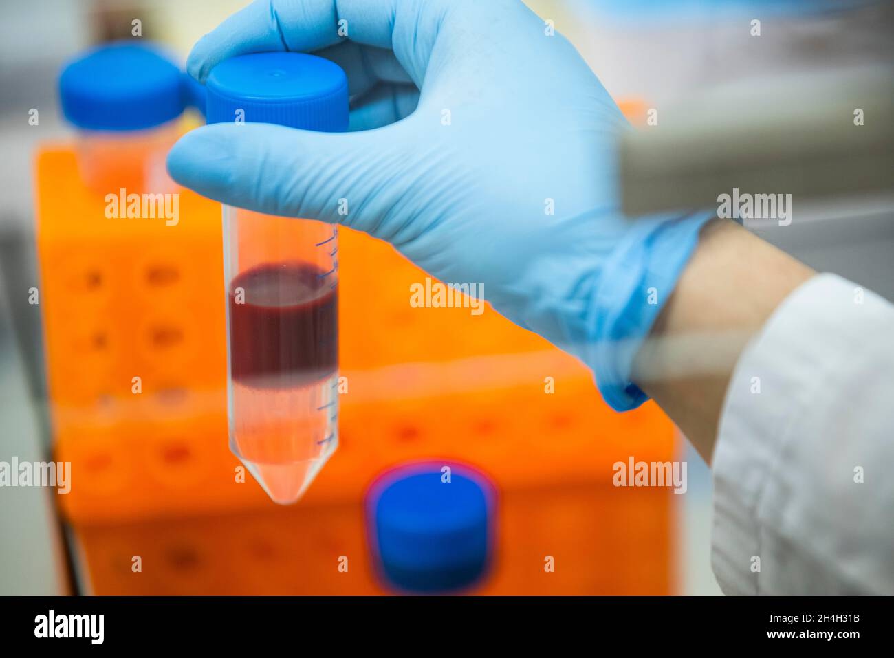 Assistente di laboratorio medico che tiene una provetta per centrifuga con sangue, Essen, Renania settentrionale-Vestfalia, Germania Foto Stock