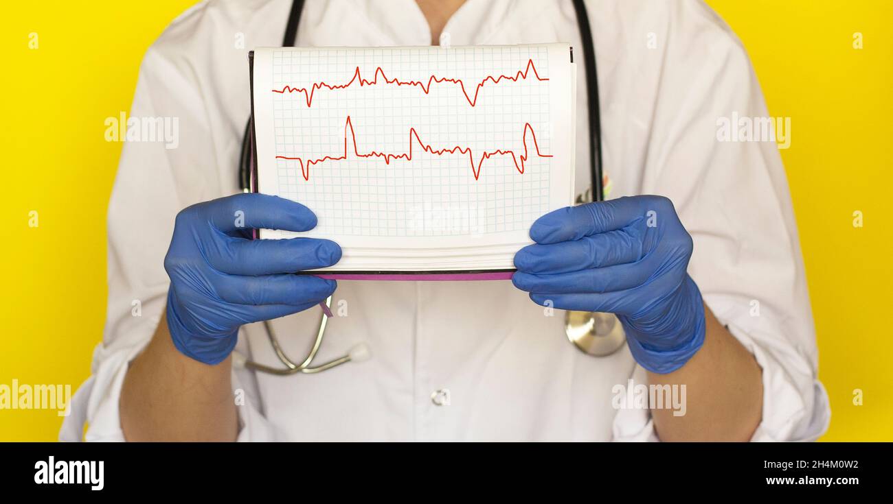 Medico con cardiogramma cardiaco e stetoscopio su sfondo giallo Foto Stock