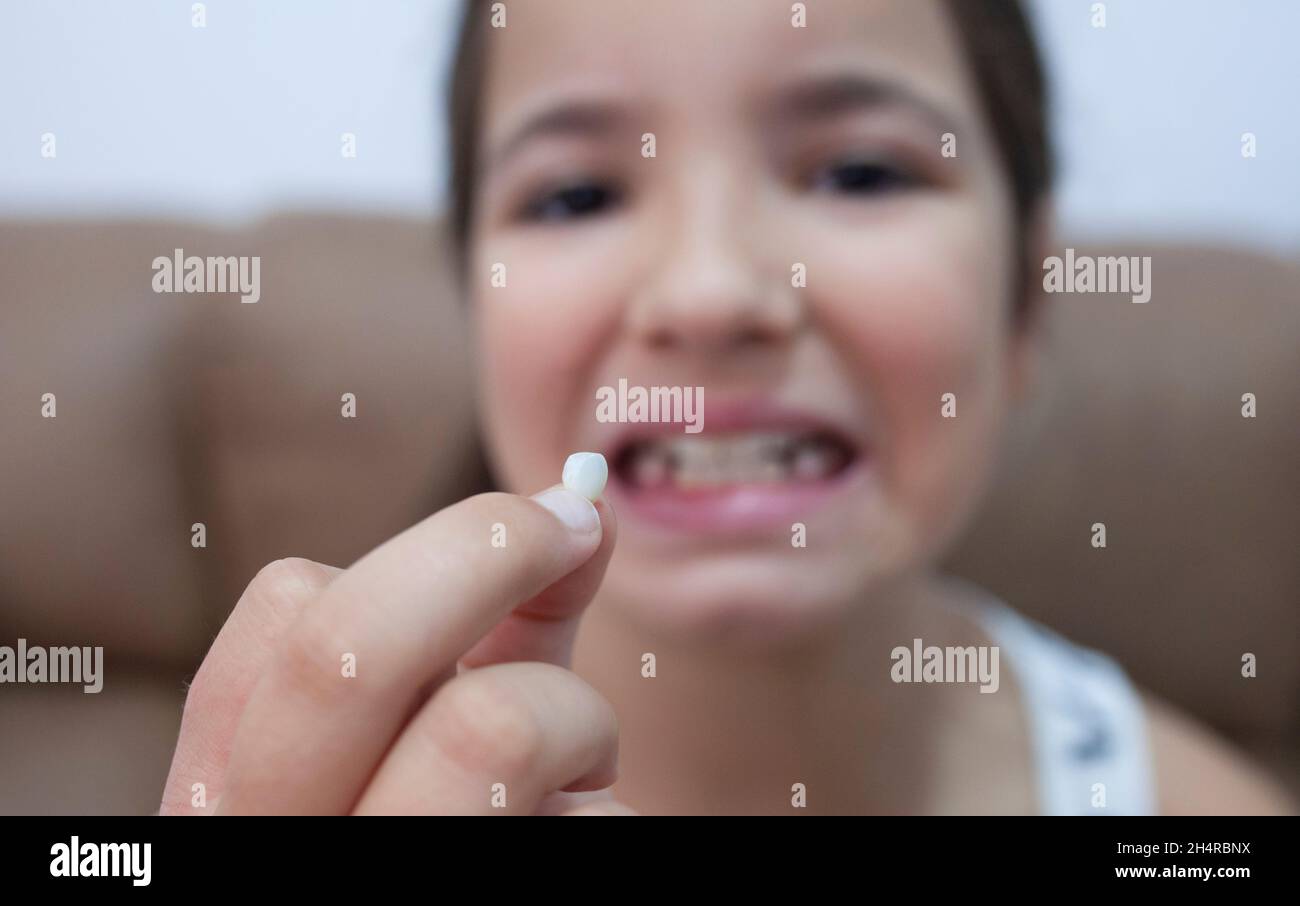 ragazza di 9 anni che mostra il suo primo dente canino caduto fuori. Messa a fuoco selettiva Foto Stock