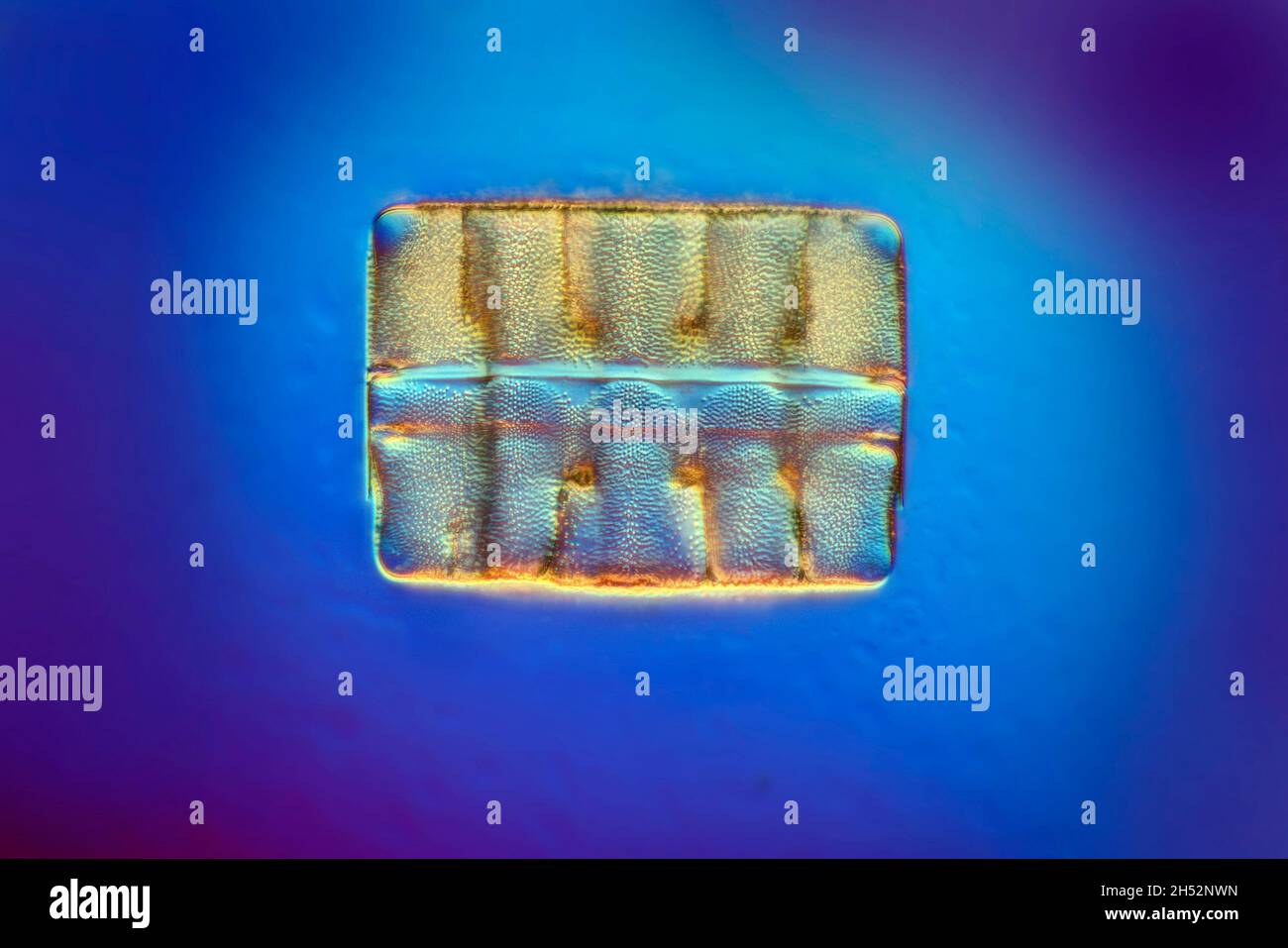 Diatom, Terpoooe intemedia, illuminazione condensatore Heine Foto Stock