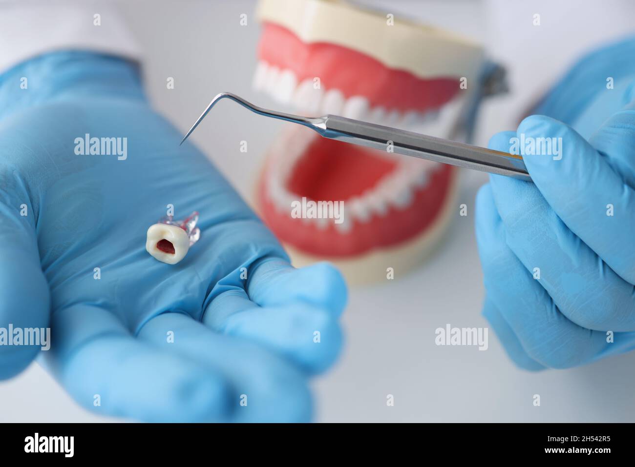 Medico dentista che tiene il dente artificiale di plastica nelle sue mani sullo sfondo della mascella closeup Foto Stock