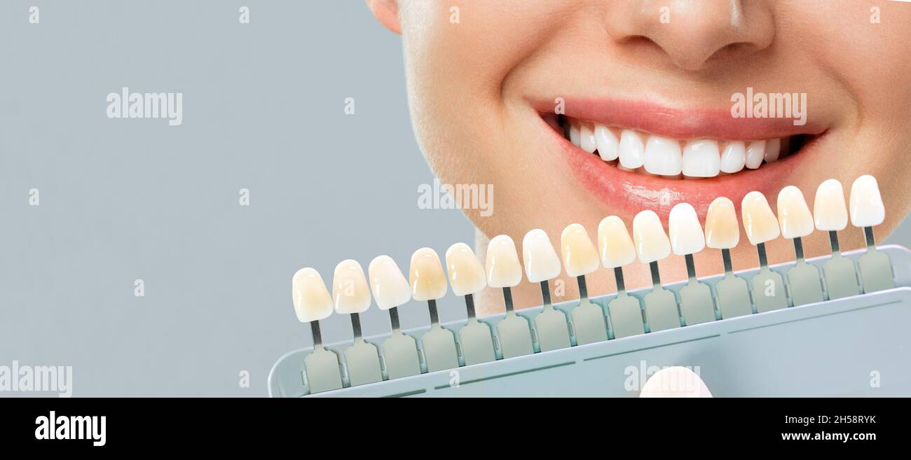 Giovane donna sorridente. Denti cosmetologici sbiancanti in una clinica odontoiatrica selezione del tono del dente dell'impianto. Foto Stock