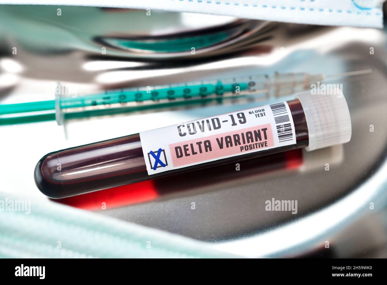 Blutprobe mit Coronavirus Delta-variante B.1.617.2, Symbolfoto Foto Stock