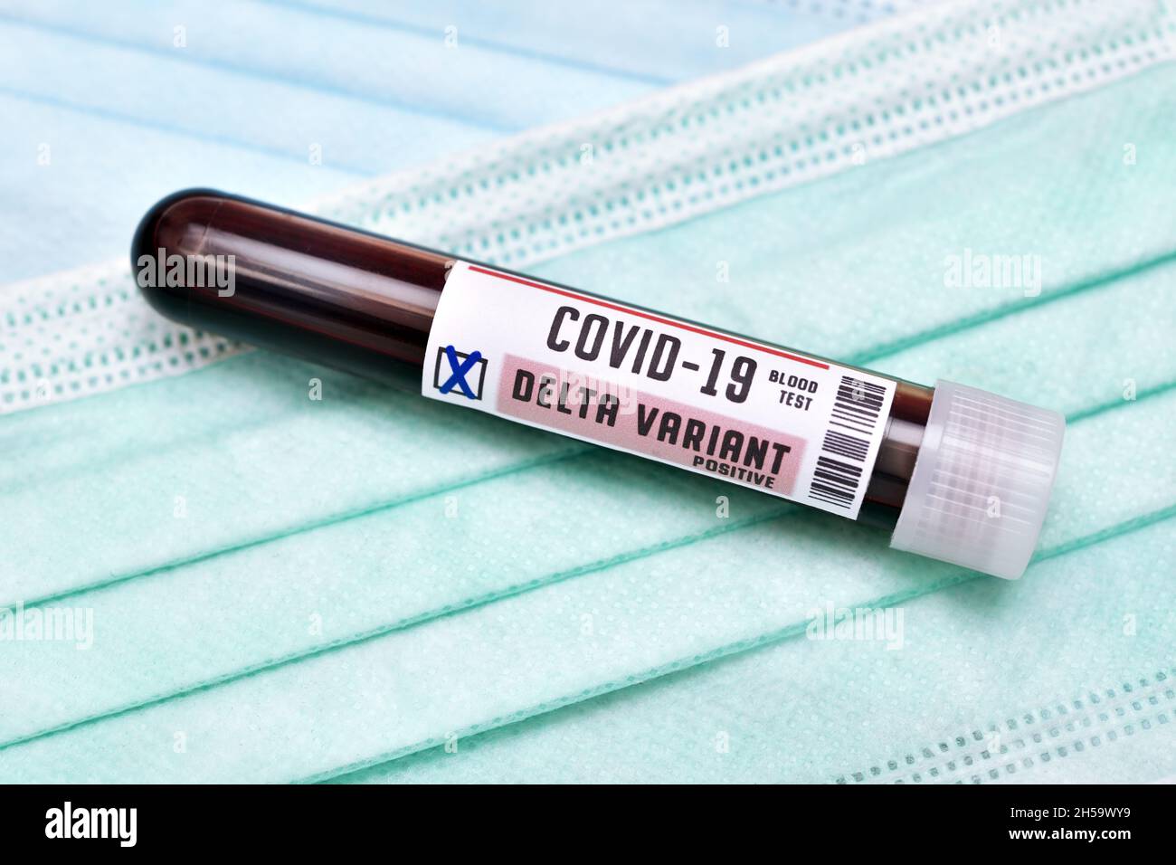 Blutprobe mit Coronavirus Delta-variante B.1.617.2, Symbolfoto Foto Stock