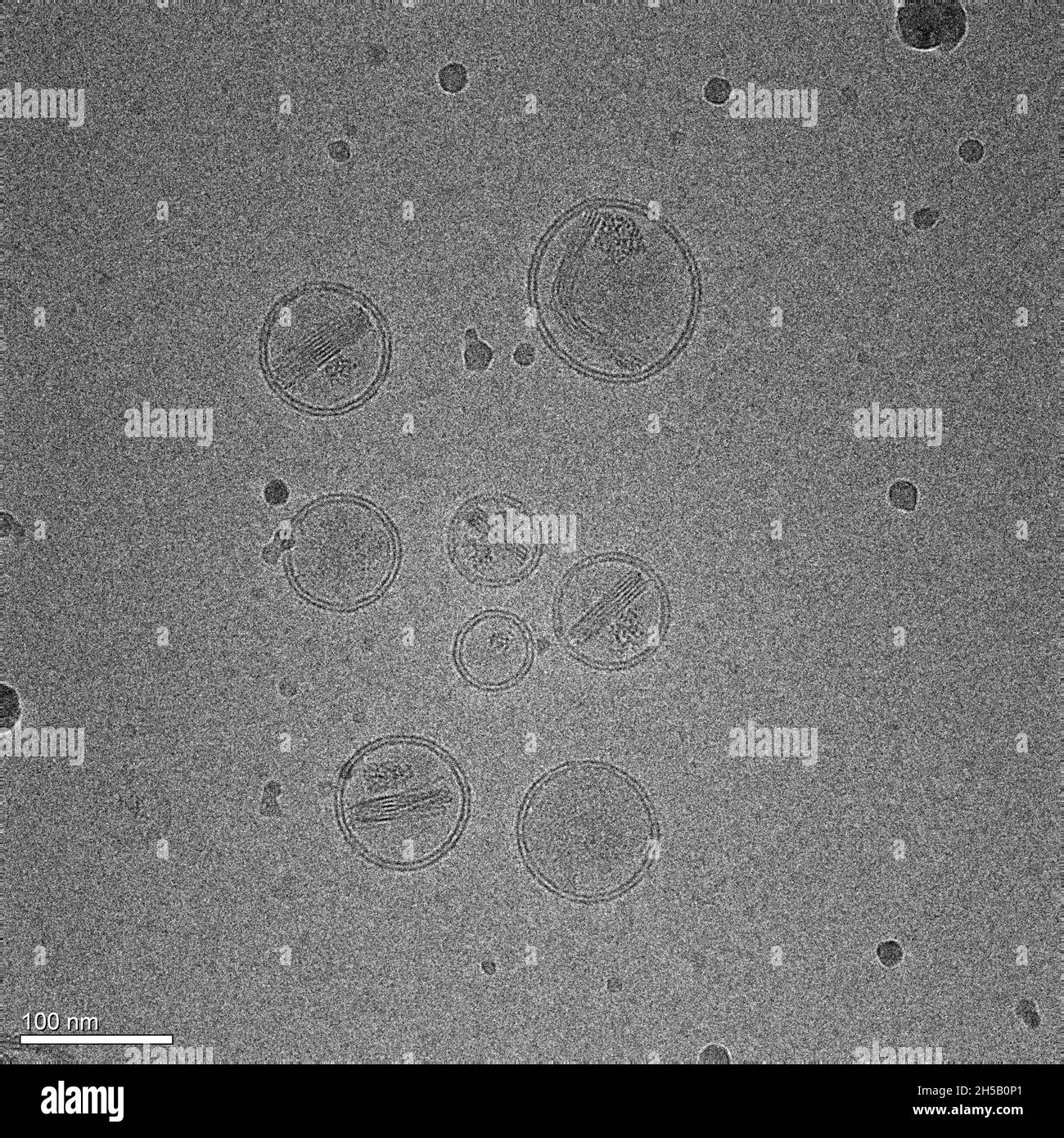 La micrografia rappresenta nanoparticelle costituite da lipidi contenenti un farmaco antitumorale Foto Stock