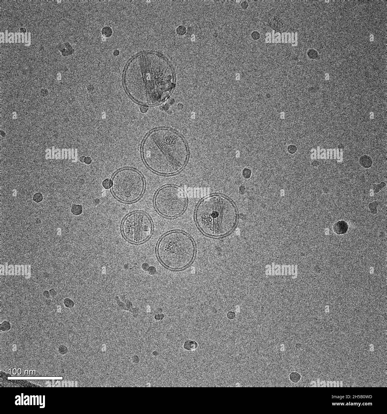 Micrografia di nanoparticelle di lipidi contenenti un farmaco antitumorale Foto Stock