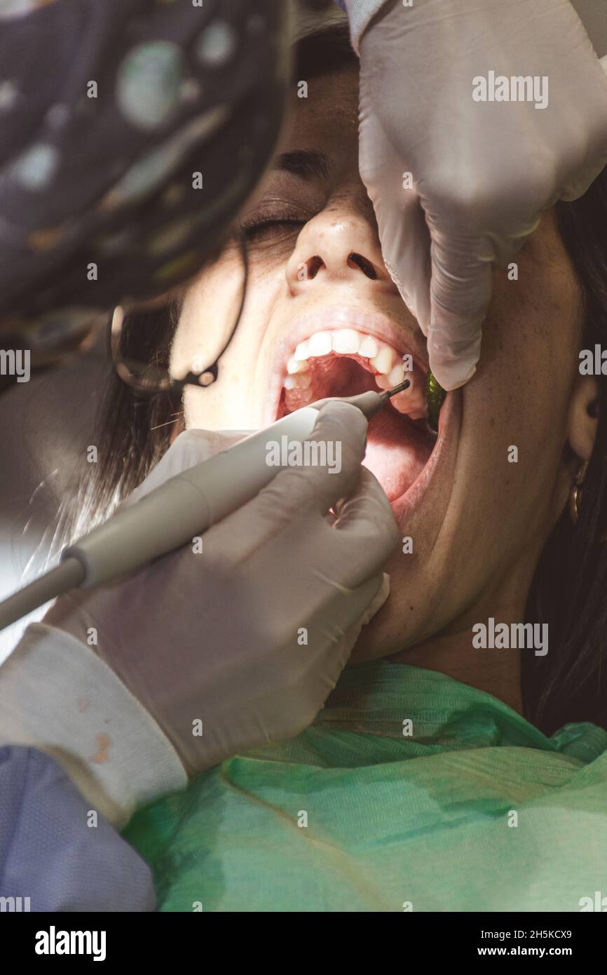 Giovane donna in clinica dentale mentre ha un trattamento di pulizia dentale Foto Stock