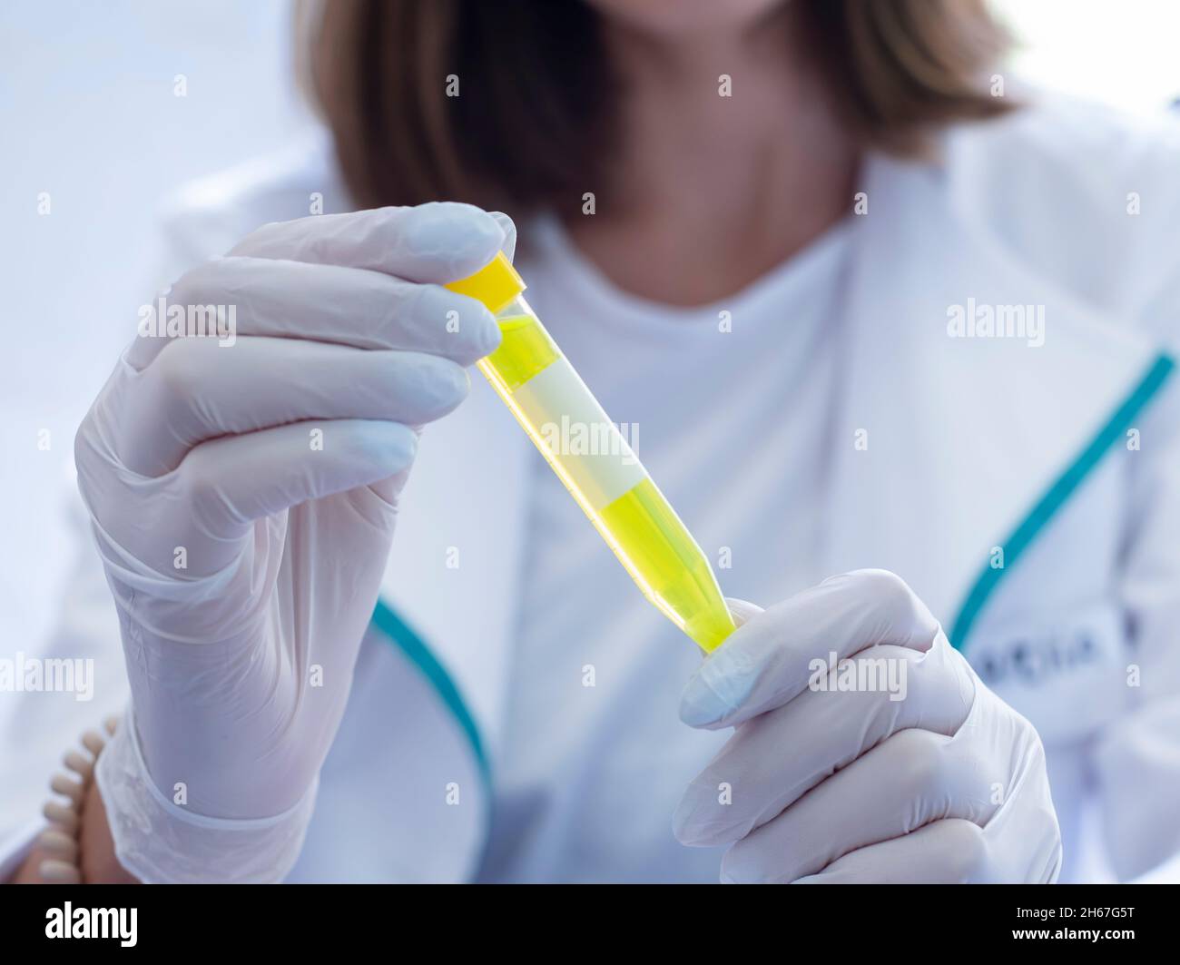 Una donna in vestaglia tiene una grande provetta con liquido giallo davanti a lei, primo piano. Foto Stock