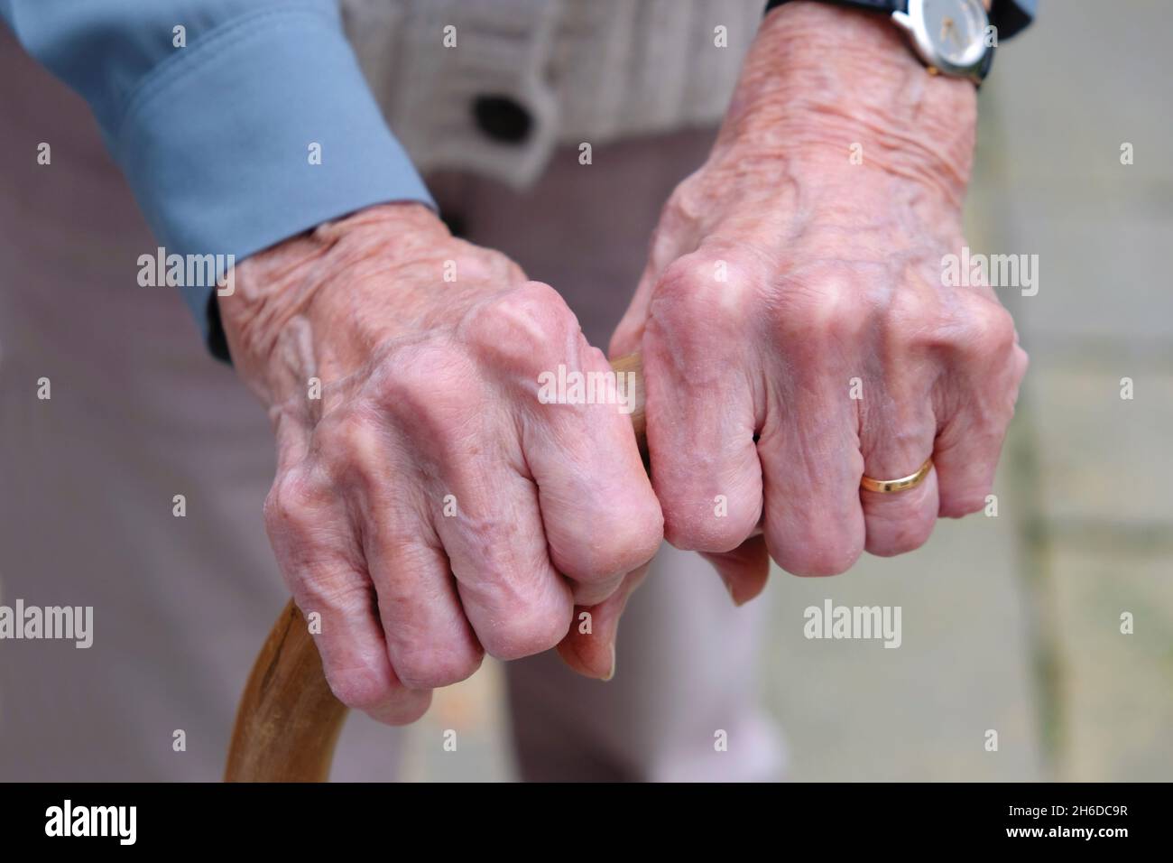 Mani di una signora anziana che tiene un bastone da passeggio Foto Stock