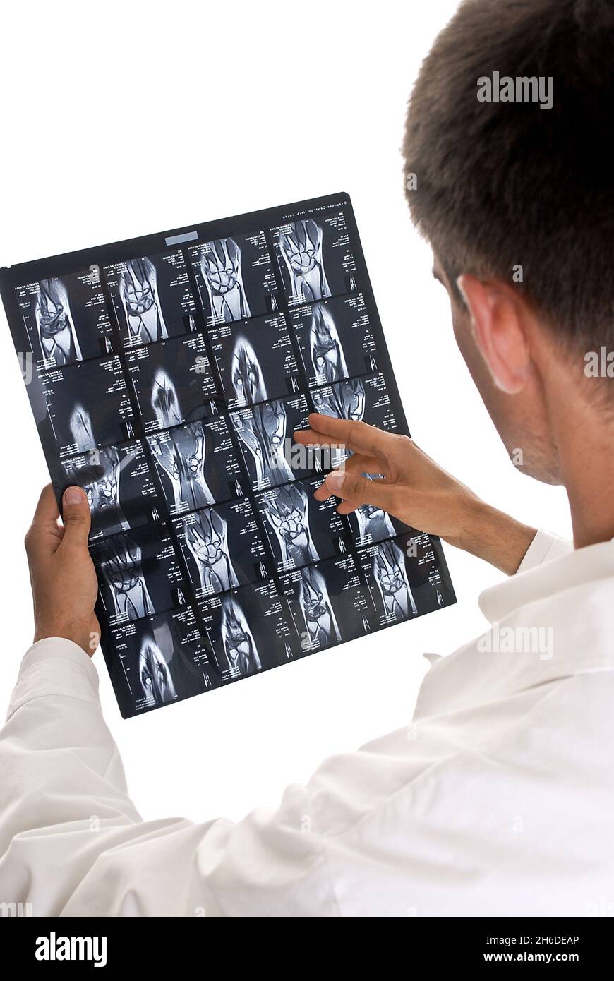 Medico con la fotografia a raggi X nelle sue mani Foto Stock