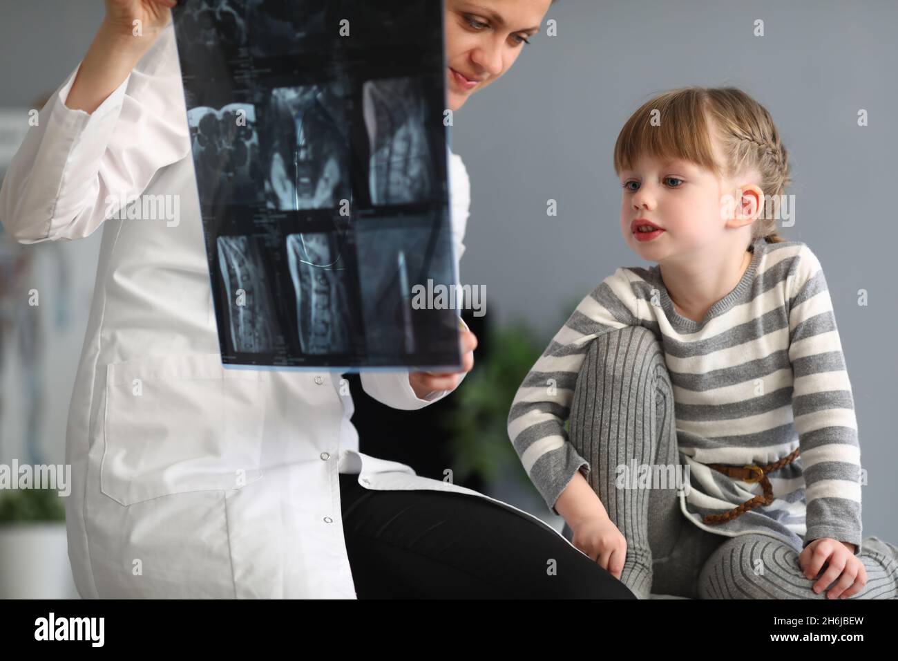 Medico donna mostra una bambina una radiografia della spina dorsale Foto Stock