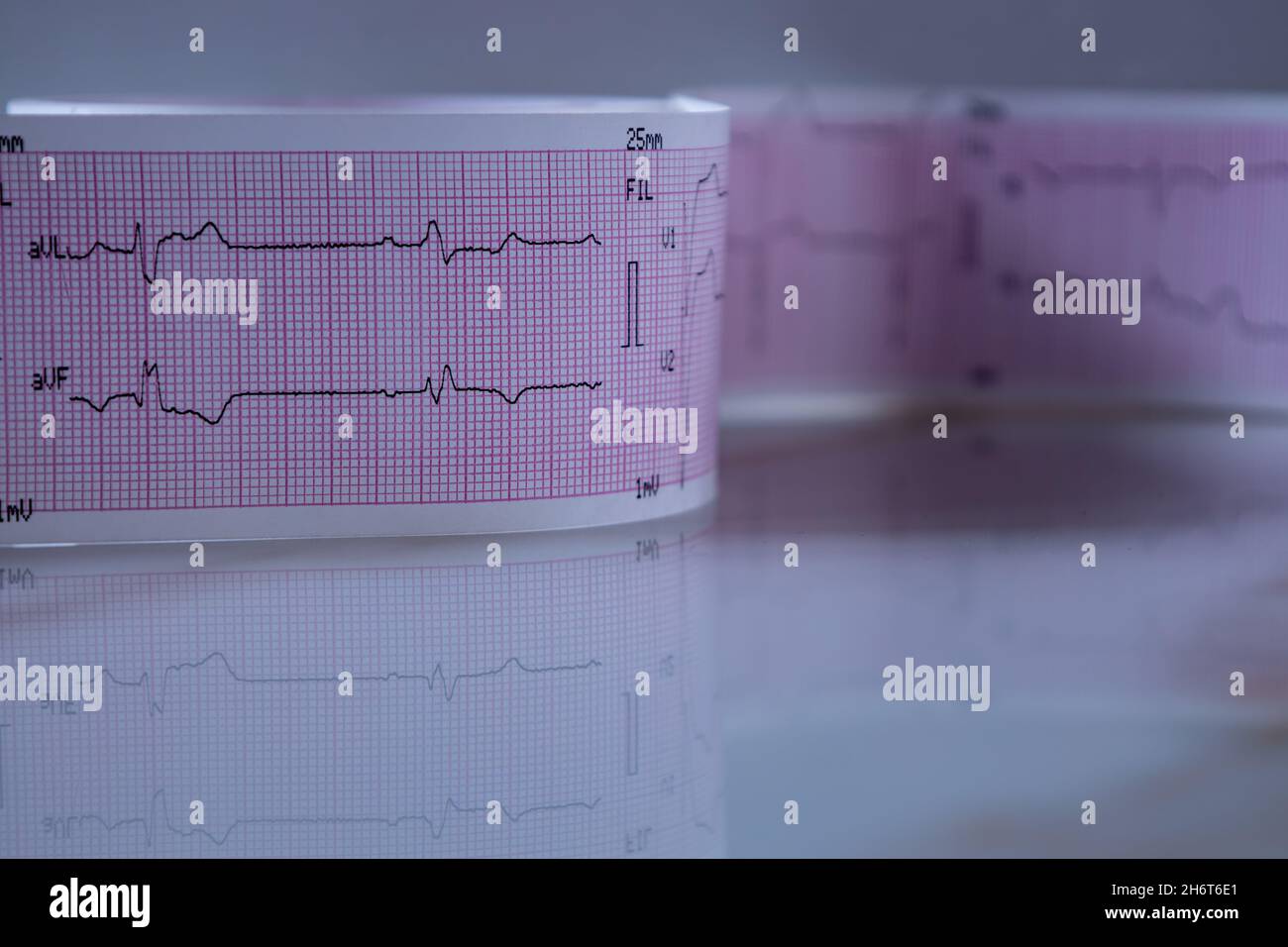 Primo piano di una striscia di carta per grafici con onde cardiache nere che formano un elettrocardiogramma. Concetto di studio o test medico. Foto Stock