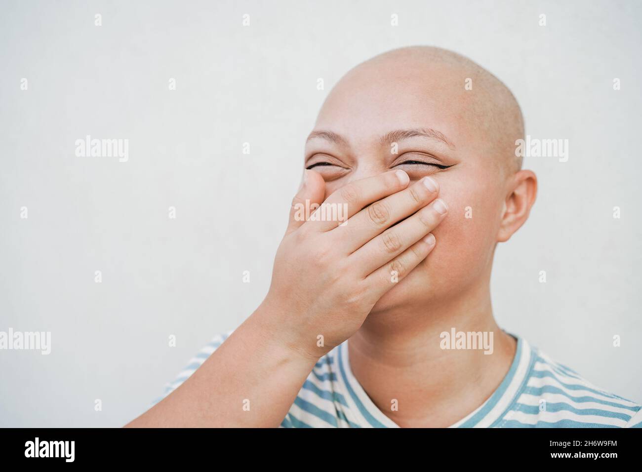 Allegra ragazza calva sorridente davanti alla macchina fotografica - fuoco sugli occhi Foto Stock