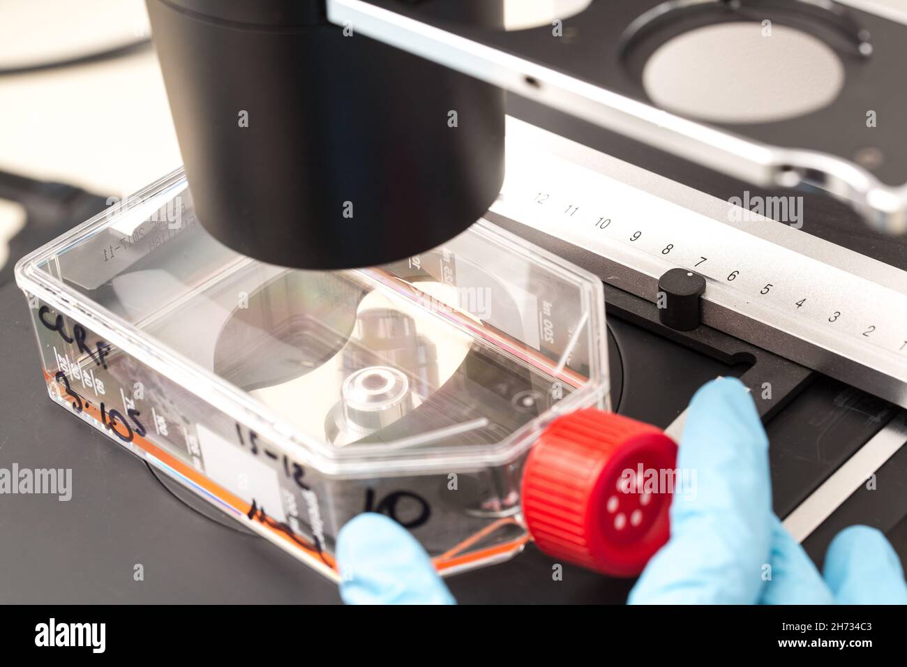 matraccio con cellule tumorali umane al microscopio, studio delle sostanze antitumorali Foto Stock