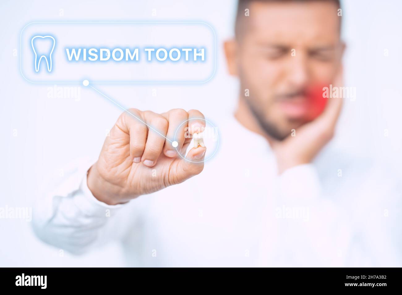 Uomo con dente di saggezza estratto. Uomo dopo chirurgia di rimozione dei denti di saggezza. Dolore ai denti della saggezza Foto Stock