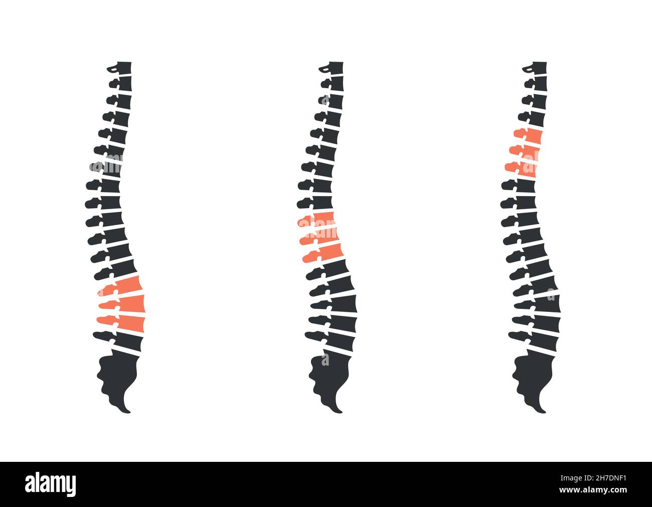 silhouette della colonna umana. mal di schiena isolato su bianco Illustrazione Vettoriale