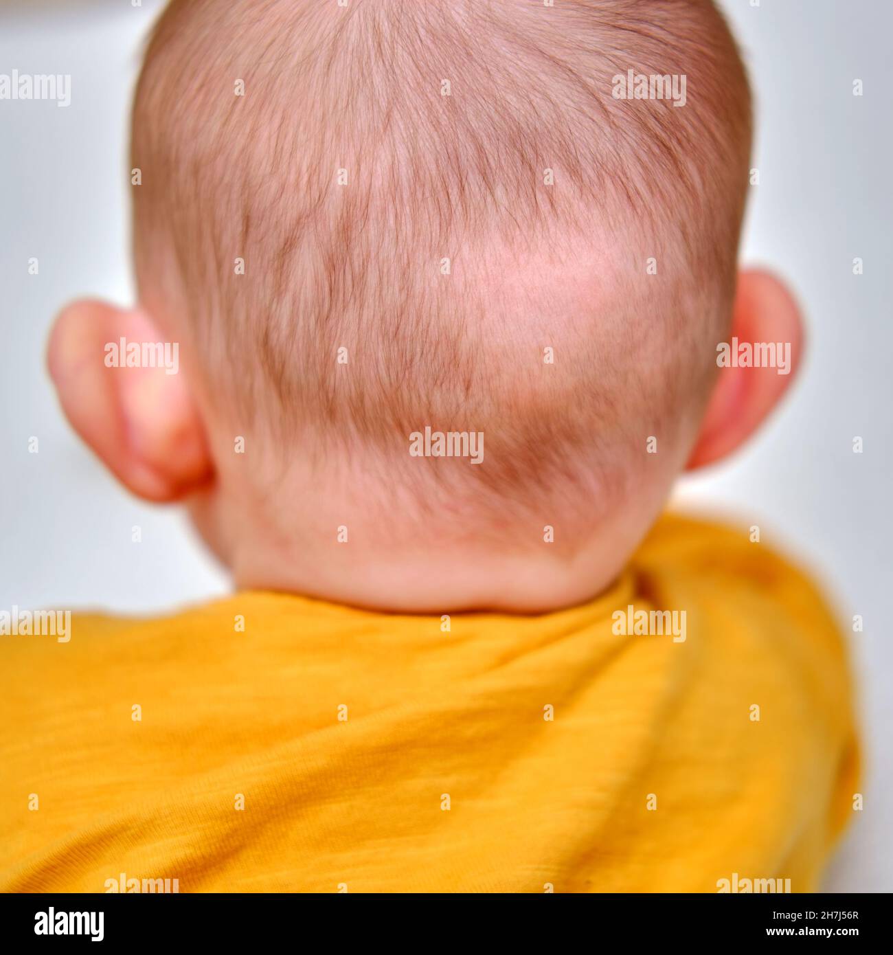 Punto calvo sul retro della testa del bambino. I capelli sfregati del bambino del toddler Foto Stock