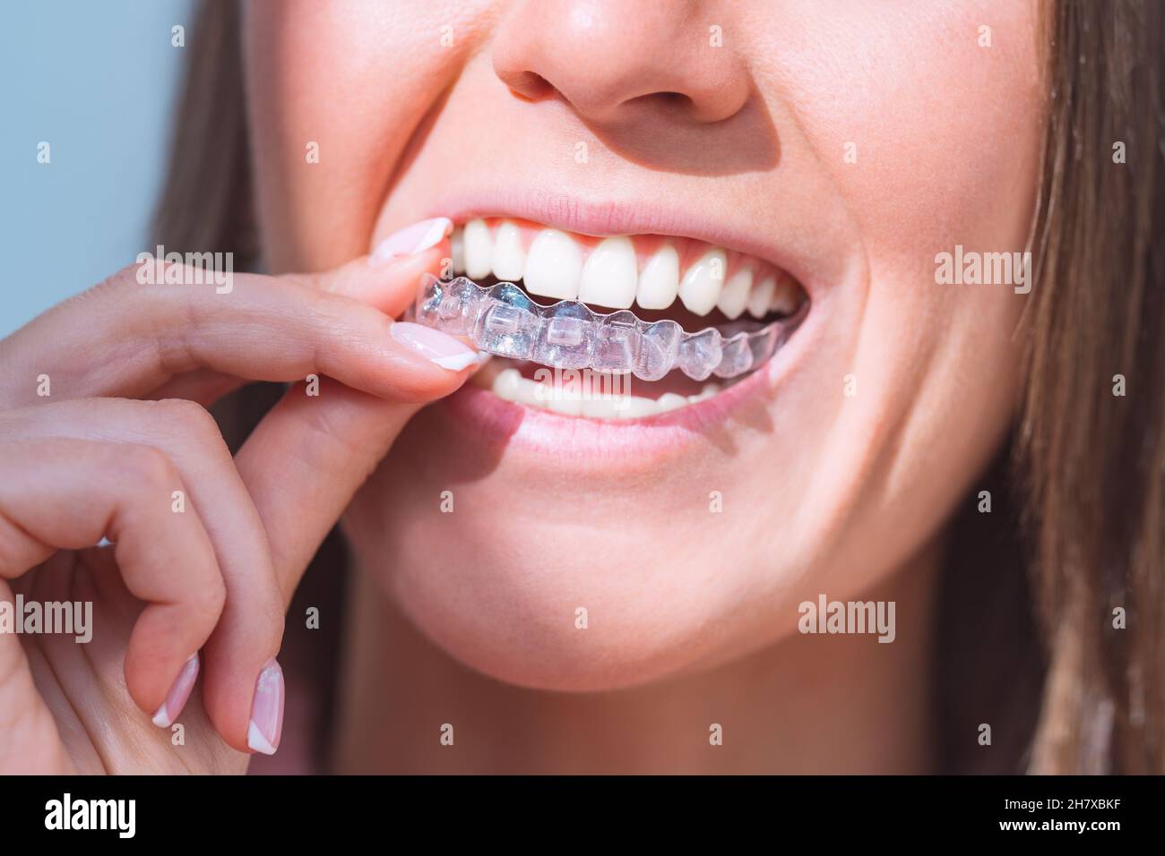 Donna con un sorriso perfetto indossando allineatori dentali invisibili per la correzione dentale Foto Stock