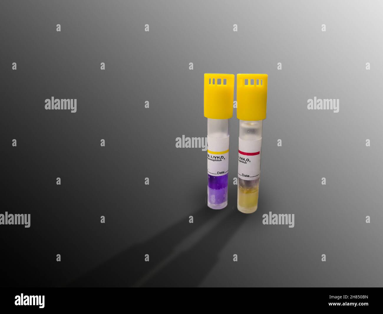 Primo piano immagine di due indicatori biologici positivi e negativi della macchina di sterilizzazione a bassa temperatura con perossido di idrogeno. Un ampolo è controllo e. Foto Stock
