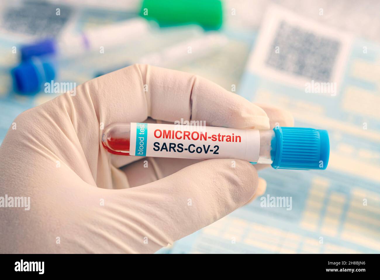 Medico con un campione di sangue positivo per la nuova variante rilevato del ceppo di coronavirus chiamato covid Omicron. Ricerca di nuovi ceppi africani e mutat Foto Stock