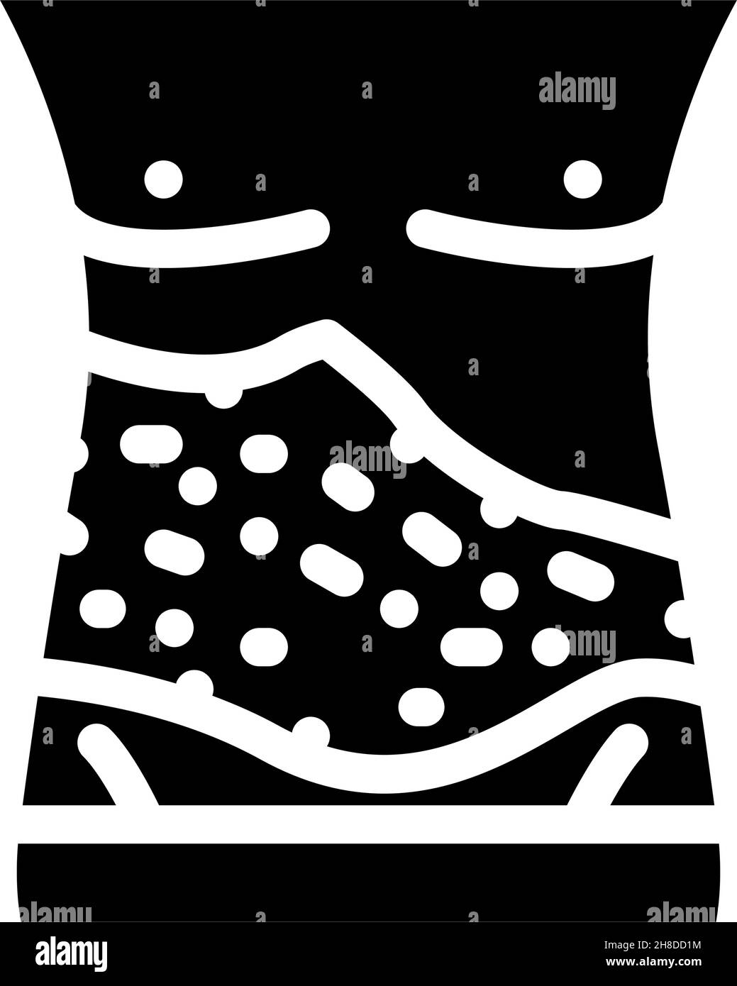 shingles malattia della pelle glifo icona illustrazione vettore Illustrazione Vettoriale shingles malattia della pelle glifo icona illustrazione vettore Illustrazione Vettoriale