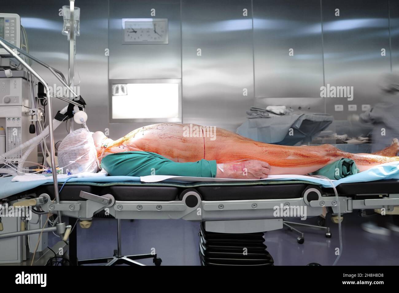 Paziente anziano sul tavolo chirurgico nella moderna sala operatoria con silhouette sfocata dell'operatore medico in uniforme sterile. Foto Stock