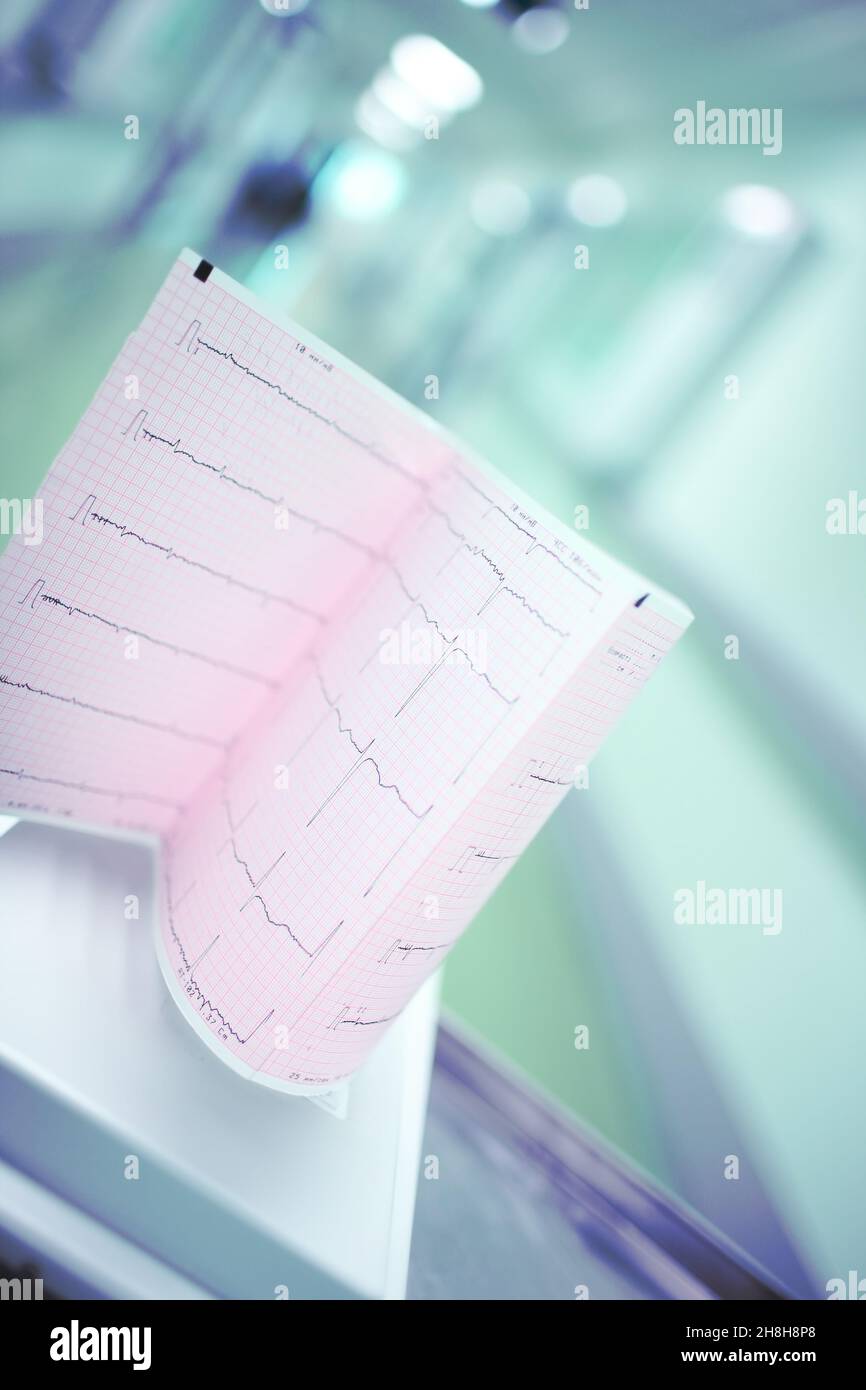 Risultato dell'esame del cuore sullo sfondo del corridoio dell'ospedale sfocato. Foto Stock