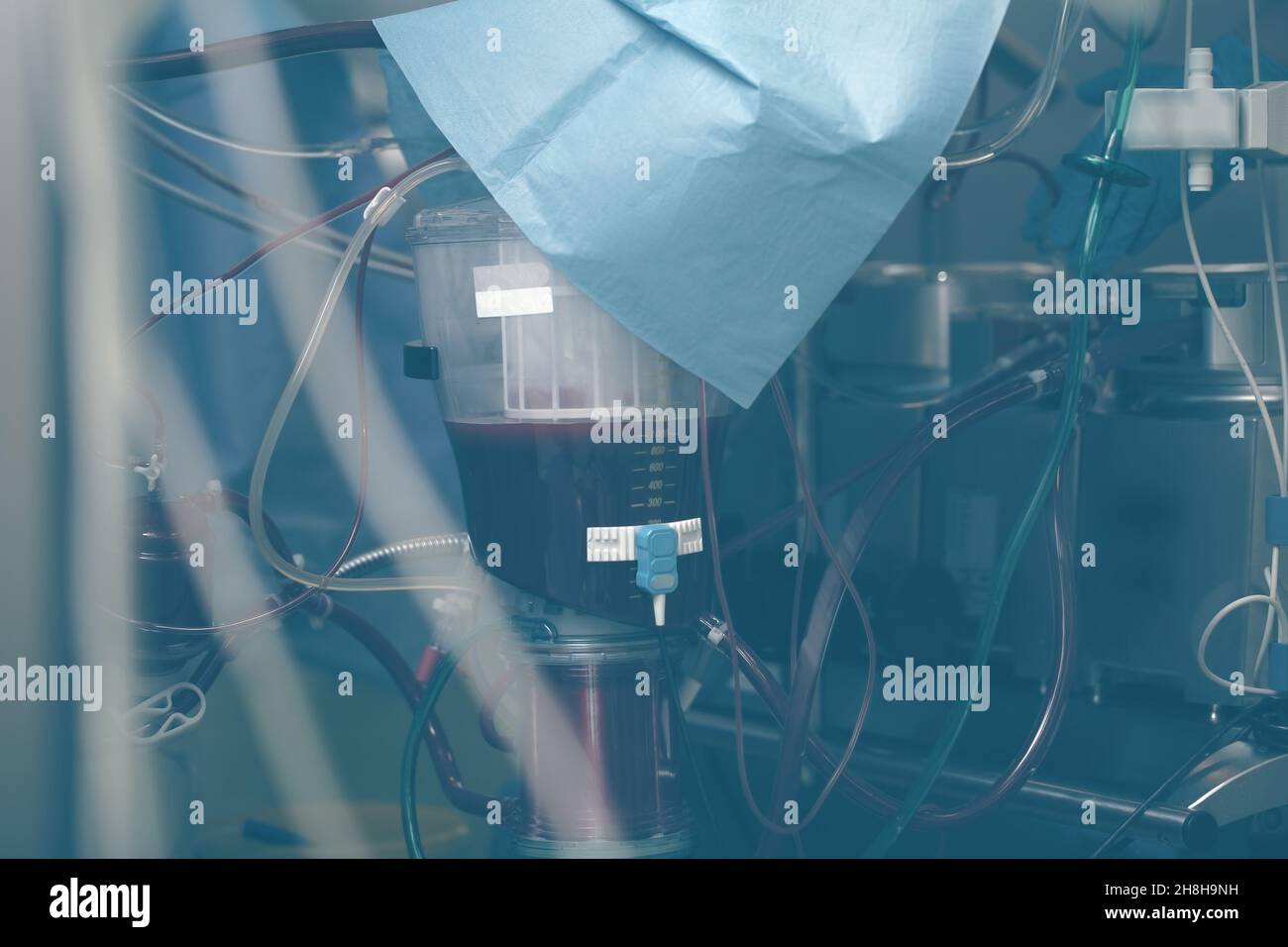 Complesso sistema di tubi, serbatoi e serbatoi in un moderno dispositivo medico, Foto Stock