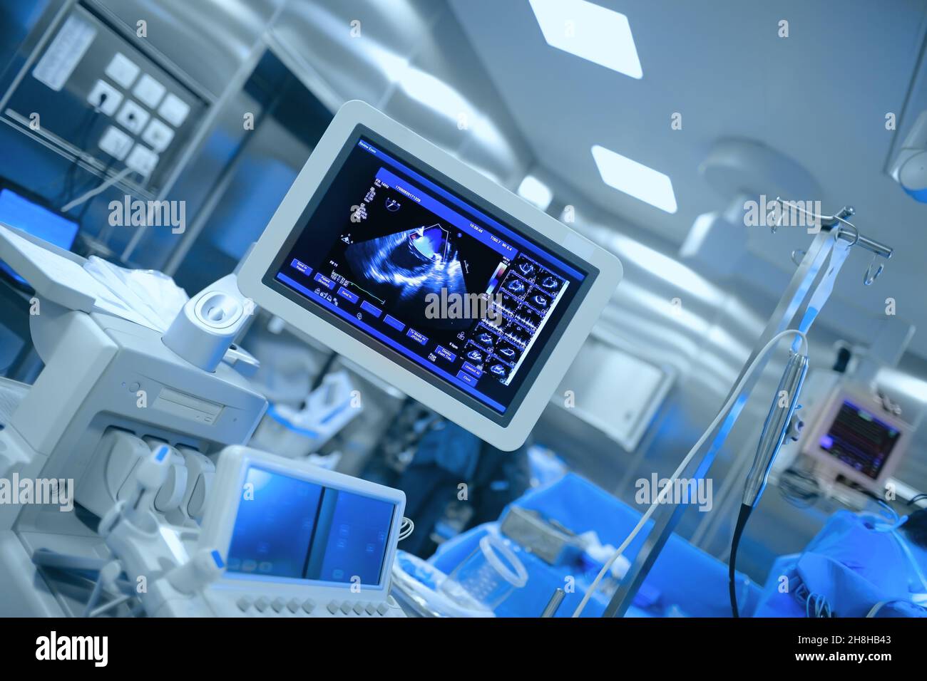 Monitoraggio a ultrasuoni del cuore del paziente durante la chirurgia cardiaca. Foto Stock