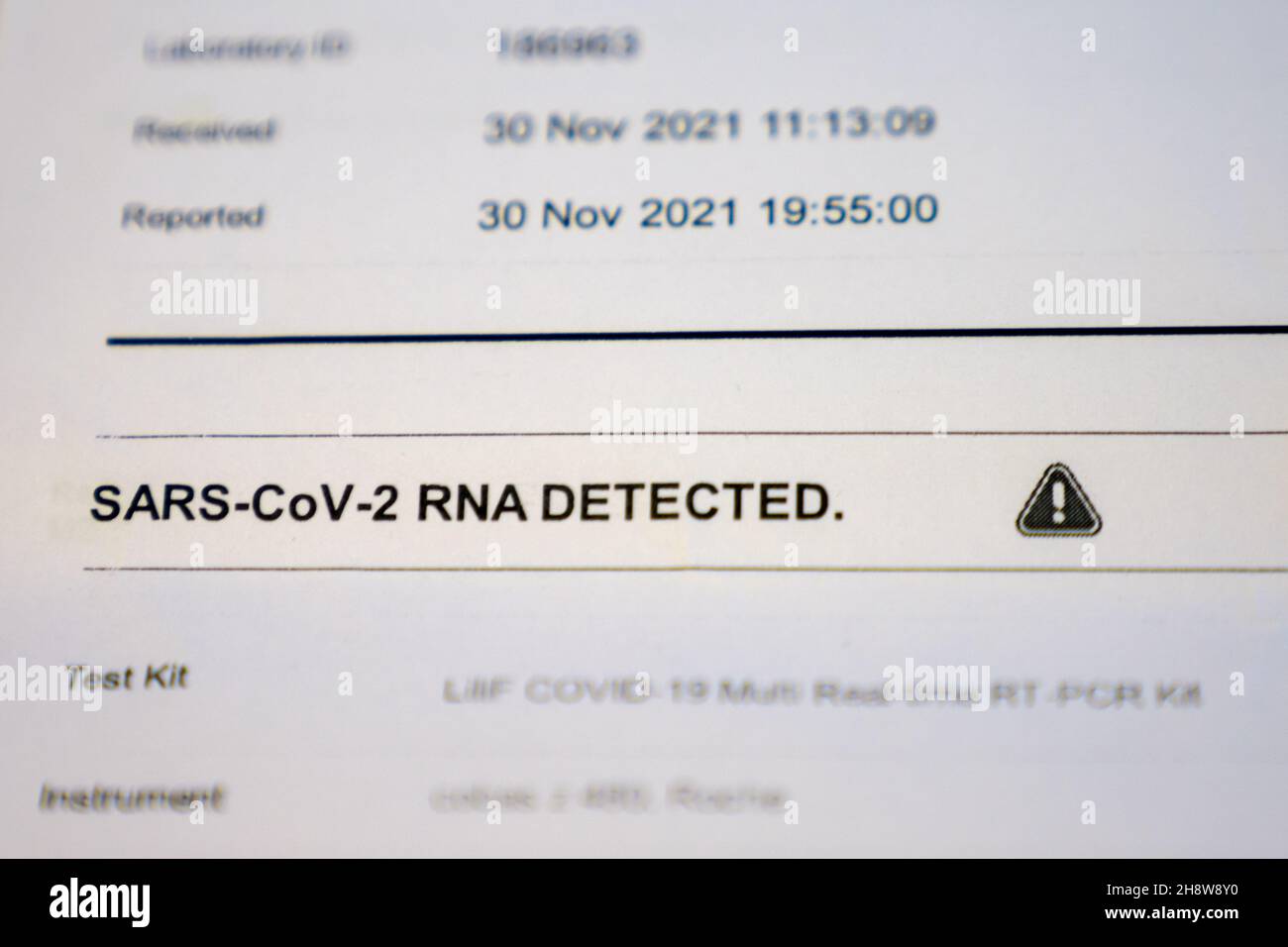 Una vista ravvicinata del fuoco selettivo di un risultato positivo del test PCR per SARS-COV-2 Foto Stock