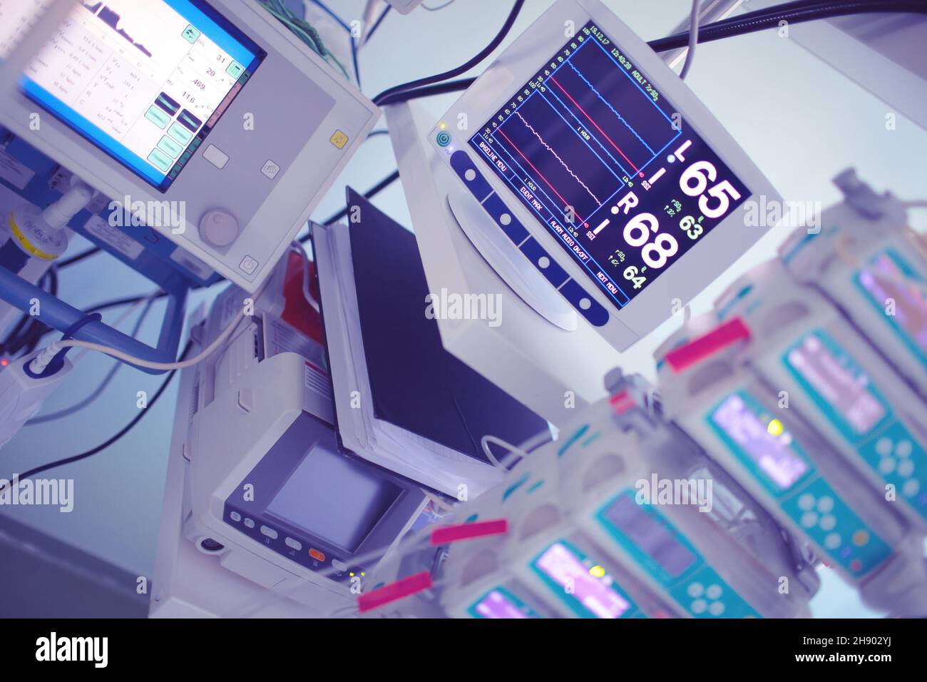 Tecnologia per il monitoraggio della respirazione di un paziente in terapia intensiva complessa. Foto Stock