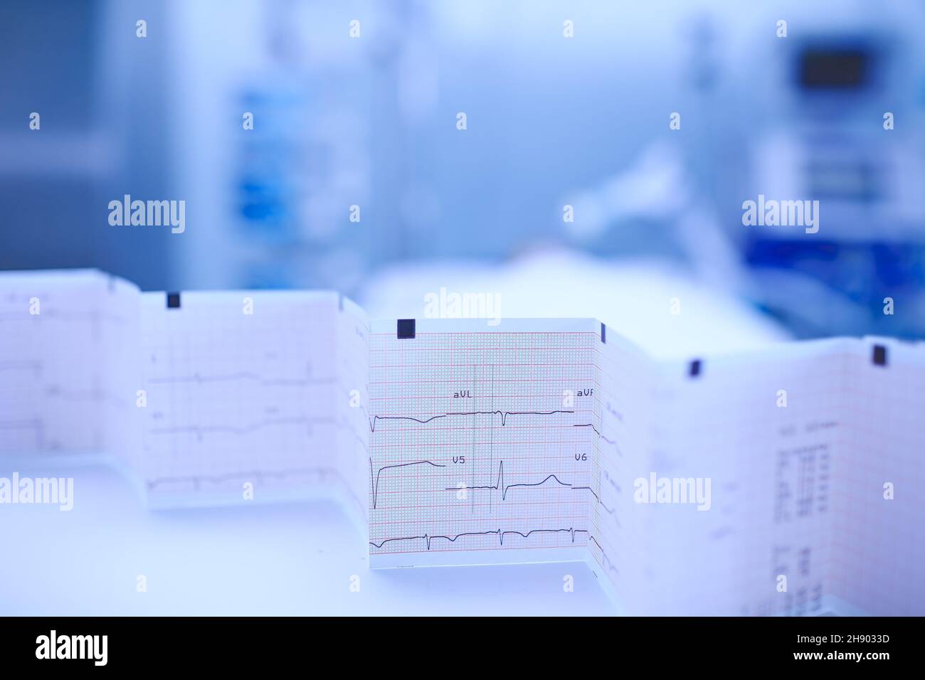 Grafico ECG ripiegato a fisarmonica sul tavolo dell'infermiere sullo sfondo del paziente che si trova nel letto. Foto Stock