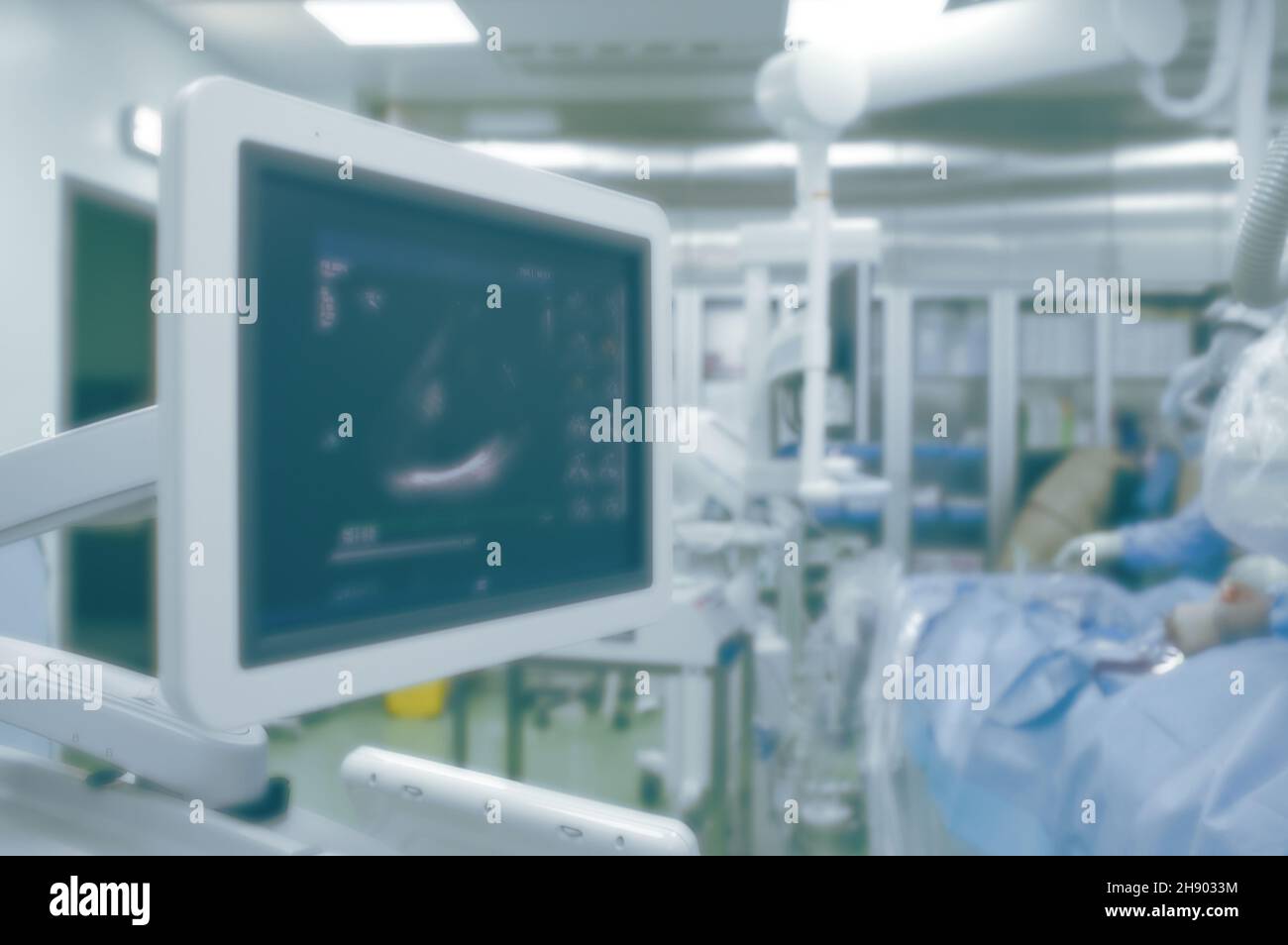 Monitoraggio a ultrasuoni della funzione cardiaca in sala operatoria dotata di tecnologie avanzate, background non focalizzato. Foto Stock