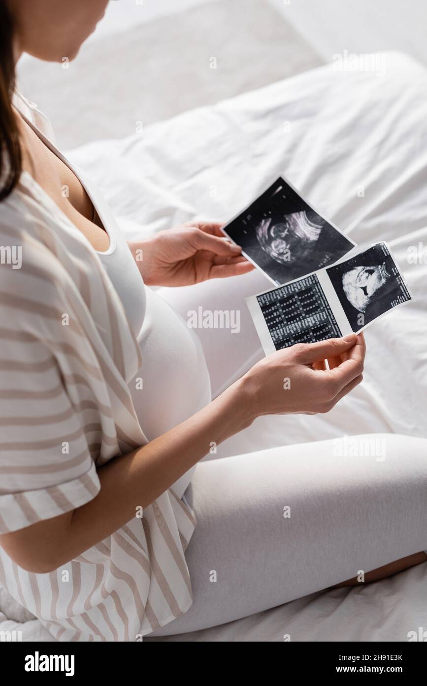 vista parziale di una donna in stato di gravidanza che esegue scansioni a ultrasuoni Foto Stock